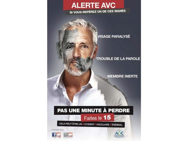 AVC 2